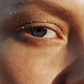 Golden Eye Speckles