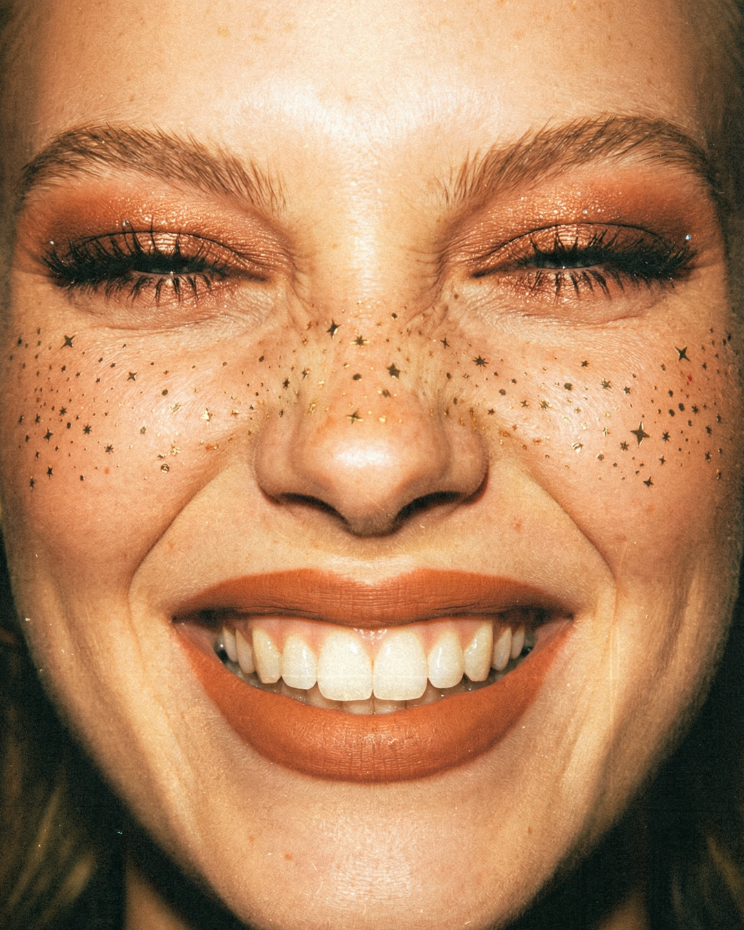 More than freckles.